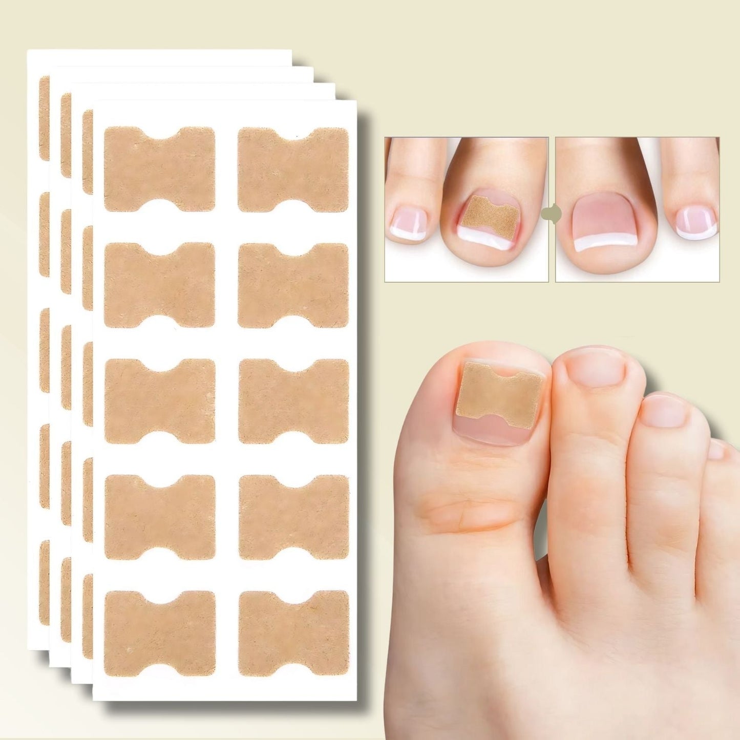 10+10 GRATIS | FixaNail - Directe Nagelreparatie