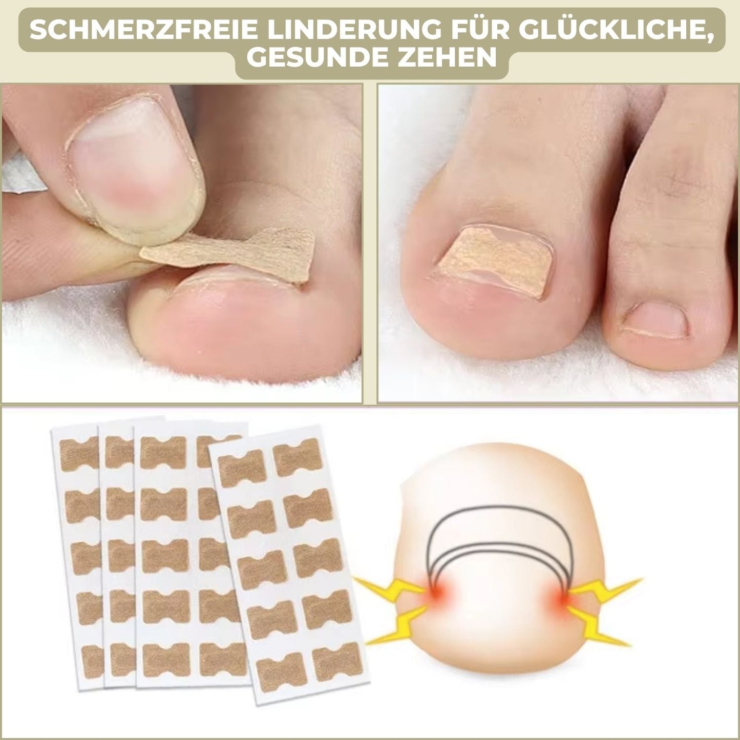 10+10 GRATIS | FixaNail - Directe Nagelreparatie