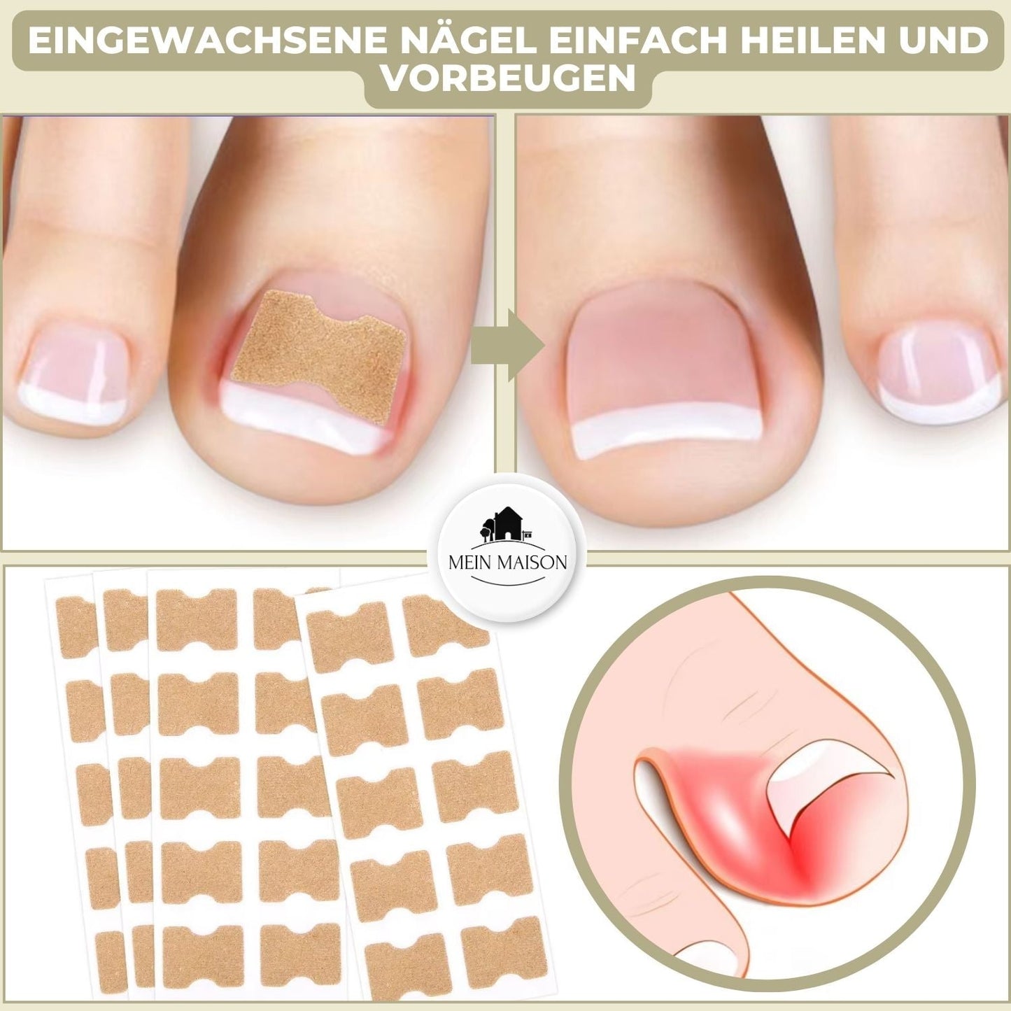 10+10 GRATIS | FixaNail - Directe Nagelreparatie