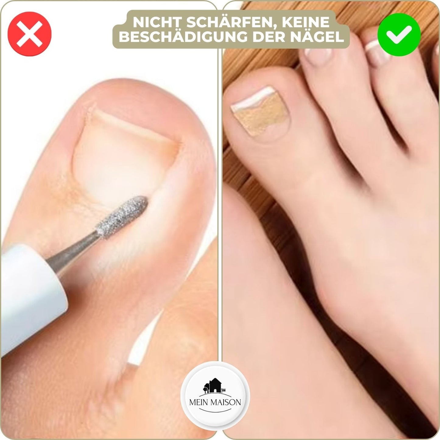 10+10 GRATIS | FixaNail - Directe Nagelreparatie